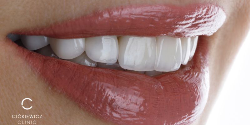 Cićkiewicz Clinic – standard, który zmienia podejście do leczenia zębów w Warszawie