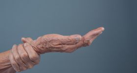 Choroba Parkinsona coraz częstsza. NFZ: rośnie liczba pacjentów na Mazowszu