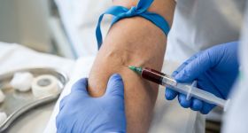 Badania krwi jako podstawa profilaktyki – co sprawdzać raz w roku?